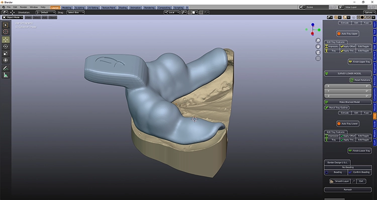 Abb. 2: Fertiges Design eines individuellen Löffels in blender for dental.