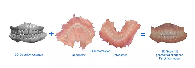 Abb. 2: Der 3D-Intraoralscan mit dem TRIOS 4 erfasst sowohl die dreidimensionale Oberfläche als auch die geometriebezogene Farbinformation.