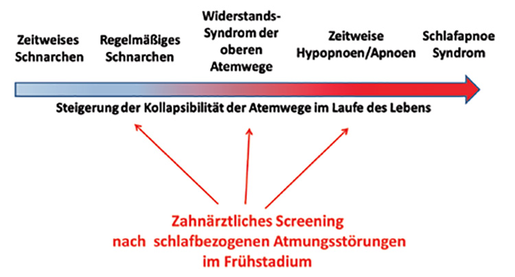 Abb. 2: Die Kollapsibilität der Atemwege nimmt, begünstigt durch Risikofaktoren, im Laufe des Lebens zu.
Die Übergänge vom leichten Schnarchen zum schweren Schlafapnoe-Syndrom sind fließend. Zahnärzte/-innen
können durch eine Identifizierung von klinischen Zeichen und Symptomen eine SBAS frühzeitig erkennen
und einer schlafmedizinischen Diagnostik zuführen.