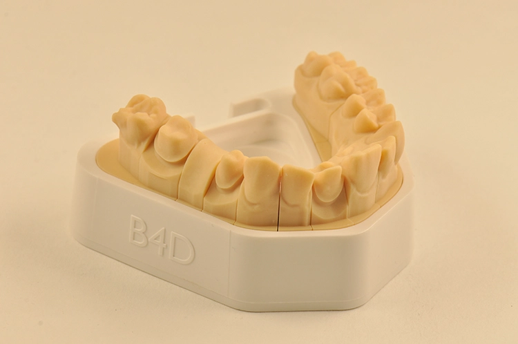 Abb. 3: VertXsplit Modell, DLP Druck.