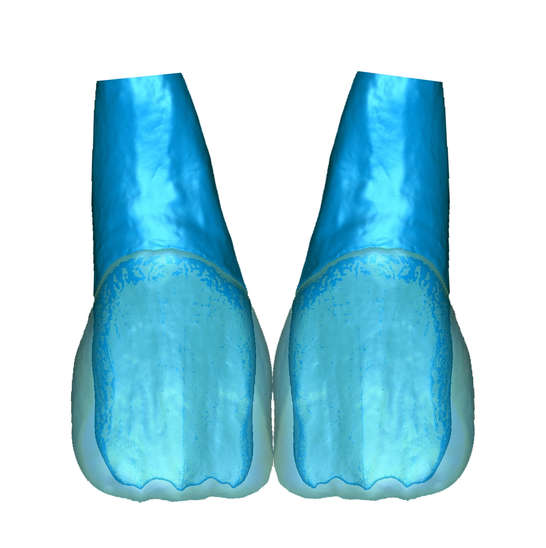 Abb. 34: Mittels Lithoz LCM-3D-Druckverfahren mehrschichtig gedruckte Zähne aus Lithiumdisilikat auf der Basis von Daten aus der „Schweiger Zahnstrukturdatenbank“.