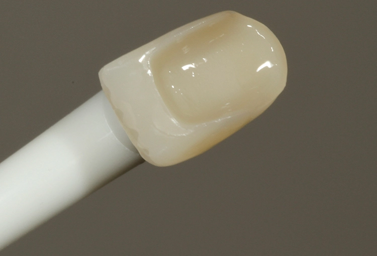 Abb. 14: Einwirken des MDP-haltigen Visalys Restorative Primers.