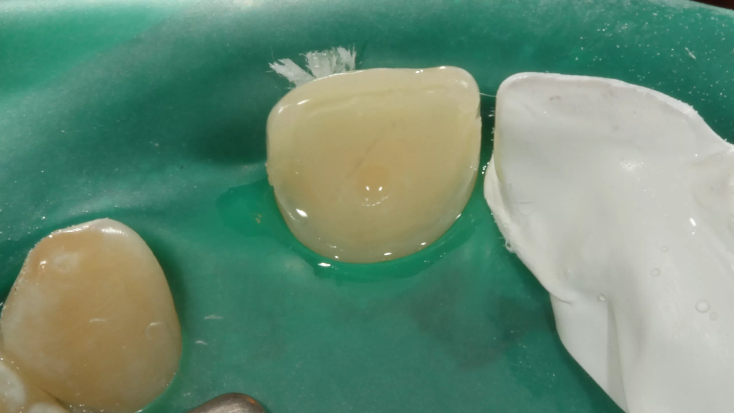 Abb. 48: Einwirken des Visalys Tooth Primers für 20 Sekunden.