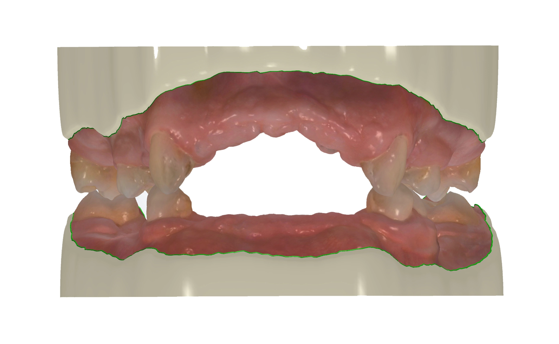 Abb. 38: Scandaten aus dem 3D-Intraoralscanner werden mittels Modelbuilder-Software (3Shape) weiterbearbeitet und bilden die Grundlage für die Herstellung von graphischen 3D-Modellen.