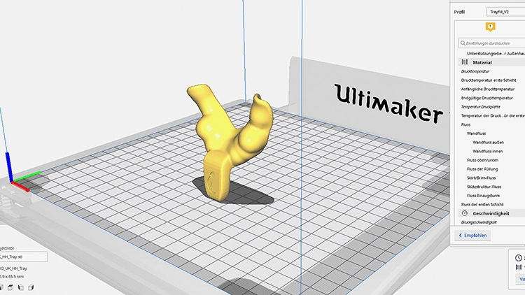 Abb. 3: Ausgerichteter individueller Löffel in der cura Software.