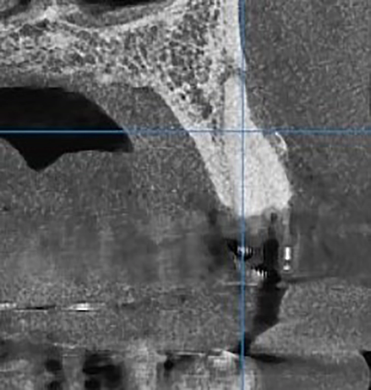 Abb. 3b: DVT-Diagnostik.