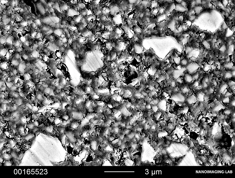 Abb. 3: Typische Gefüge dentaler Befestigungsmaterialien. Füller (hell) sind in eine Kunstharzmatrix (dunkel) eingebettet. e: RelyX Unicem 2 Automix (3M).