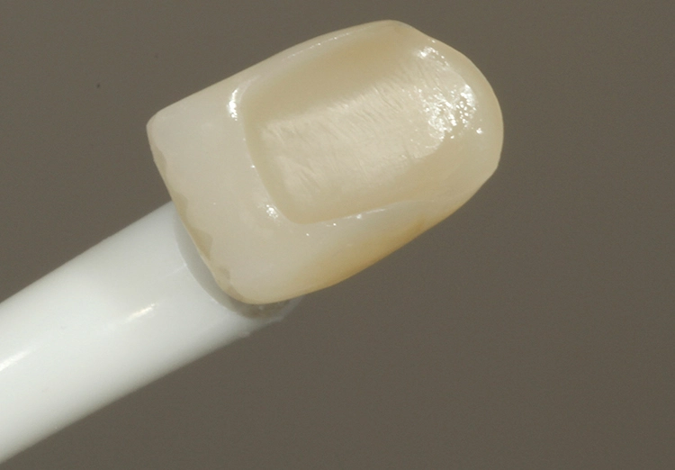 Abb. 15: Der fast vollständig evaporierte Restorative Primer.