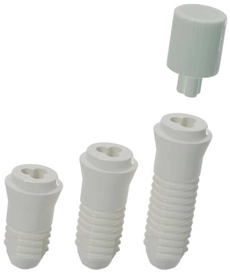 Das zweiteilige Patent™-Implantat ist in Längen ab 7 mm verfügbar. Ein Glasfaser-Postt wird supragingival sicher mit Relyx Unicem (3M Espe) und ohne Bondingsysteme in die „C-Connection“ eingeklebt.