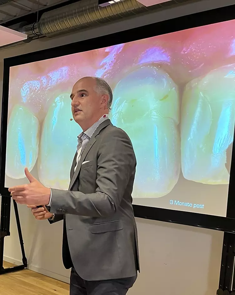 Abb. 4: Prof. Dr. Stefan Fickl, Fürth, sprach
über „Sofortimplantate in der ästhetischen
Zone – was habe ich in den letzten 10 Jahren
gelernt“. Sein Tipp: Abutments besser konkav
arbeiten.