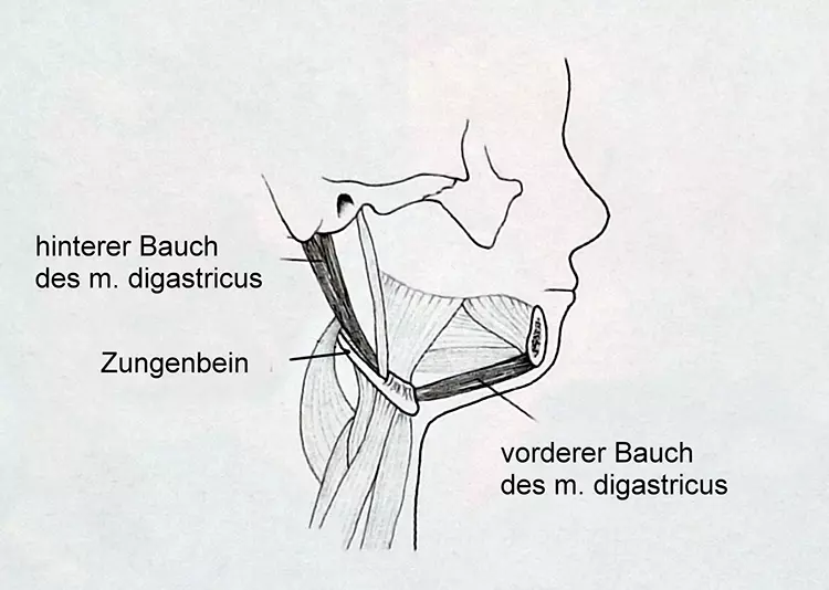 Abb. 4: Anhebung des Hyoids und Straffung des Mundbodens durch Vorverlagerung des Kinnsegmentes; aus Lindorf: Die Kinnplastik zur Verbesserung des
Gesichtsprofils [9].
a: prä Op.