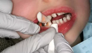 .
