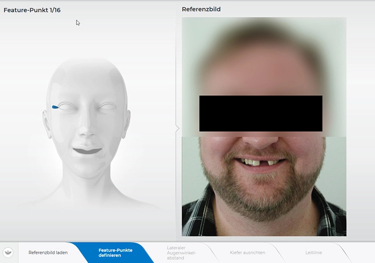 Abb. 4: Die eingepflegte Frontalaufnahme des Patienten im CEREC Smile Design.