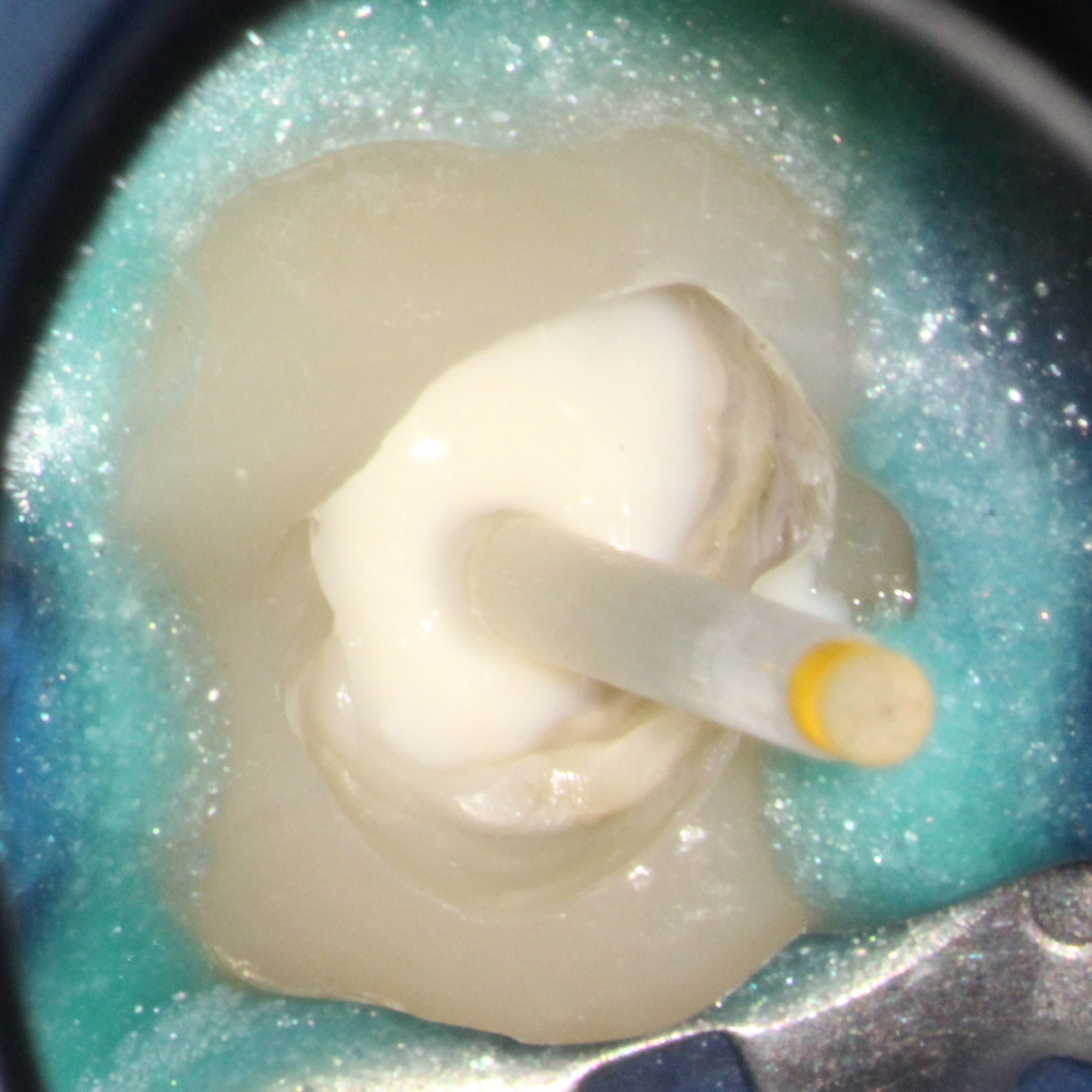 Abb. 58: 1. Schicht Visalys CemCore Opaque nach der Polymerisation ohne Gelbfilter.