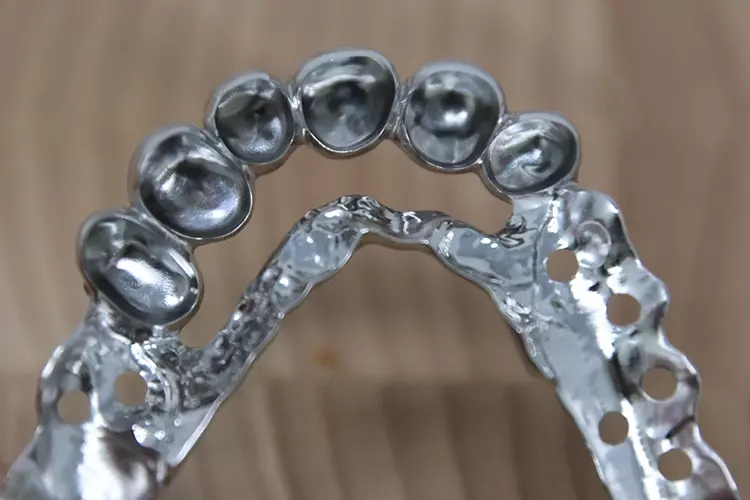 Abb. 5: Ausgearbeitete Sekundärstruktur nach Passungskontrolle und Politur.