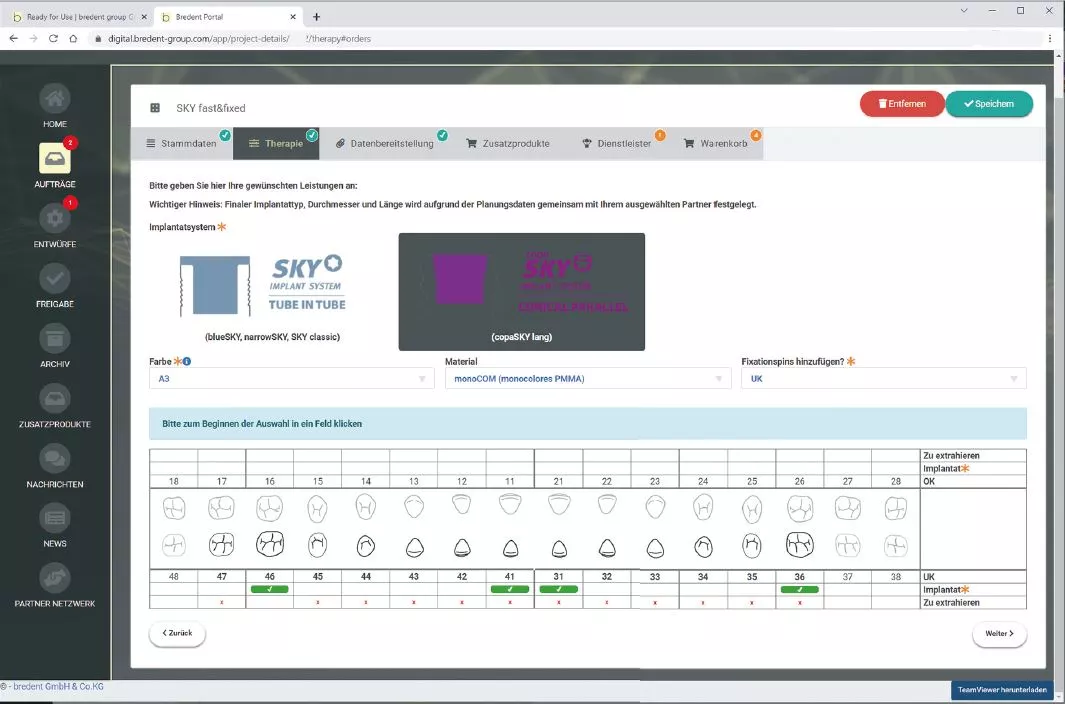 Abb. 5: Eingabe der Behandlungsparameter zur Informationsweitergabe an das Fertigungszentrum.