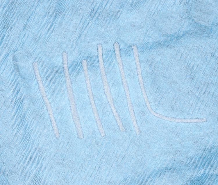 Abb. 5: Getrimmtes Superfloss zum Aufdehnen der Tasche („TensionAccess“ der Praxis Dr. Gutsche).