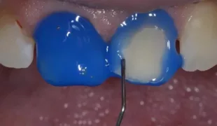 .