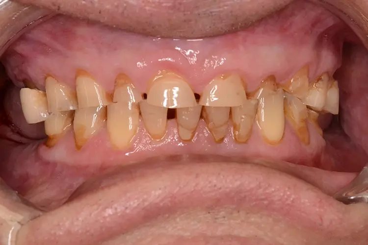 Abb. 5a: Ausgangssituation.