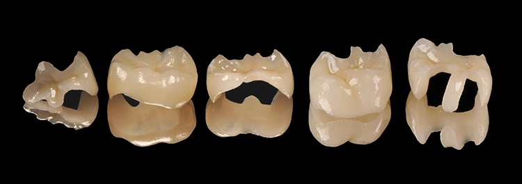 Abb. 14: Fertiggestellte Teilkronen nach dem Malfarben- und Glasurmassebrand.