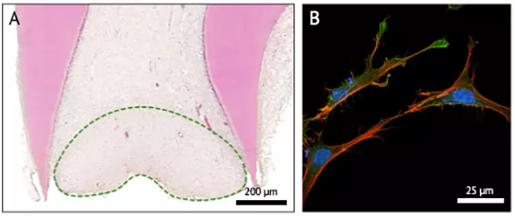 Abb. 7: Die Stammzellen der apikalen Papille
A) Histologische Aufbereitung und Hämatoxylin-Eosin-Färbung der Wurzel eines nicht ausgewachsenen Zahnes. Die Papille wurde markiert.
B) Fluoreszenzfärbung der aus der apikalen Papille isolierten Stammzellen.