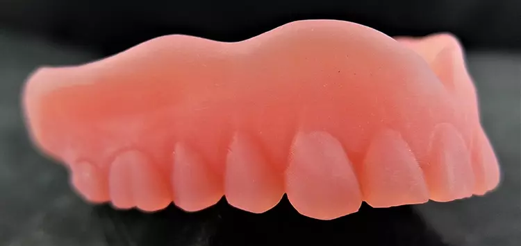Abb. 6: Klarer Vorteil gegenüber dem analogen Verfahren: Das gedruckte Duplikat der vorhandenen Prothese (Denture Base OP, Formlabs) erfüllt gleich mehrere Kriterien und erleichtert den Arbeitsaufwand sowohl in der Praxis als auch im Labor.