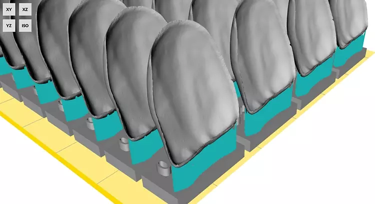 Abb. 6: Virtuelle Positionierung der Veneer-Schalen auf der Bauplattform und Generierung der Stützstrukturen.