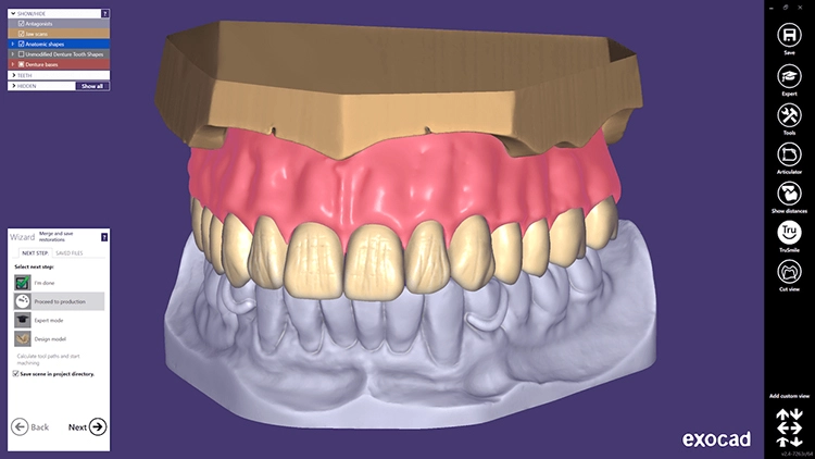 Auf das aktuelle DentalCAD 2.4 Plovdiv Release wird das exoplan 3.0 Galway-Release folgen.