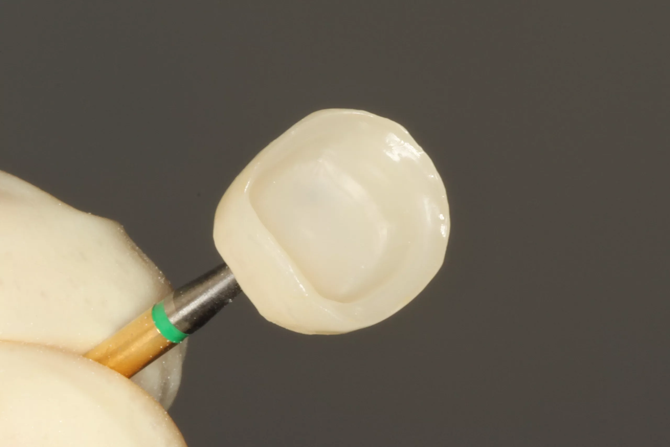 Abb. 6: Einwirken des MDP/Silan-haltigen Kettenbach Visalys Restorative Primers auf der abgestrahlten Zirkonoxidkrone.