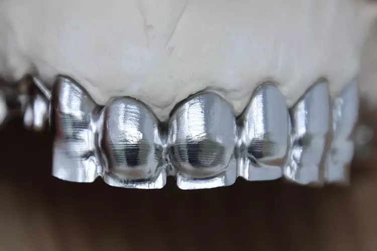 Abb. 6: Ausgearbeitete Sekundärstruktur nach Passungskontrolle und Politur.