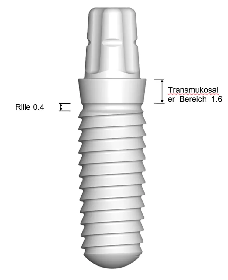 Abb. 7: Das 1-teilige Zirkonoxidimplantat ceramic. implant.
