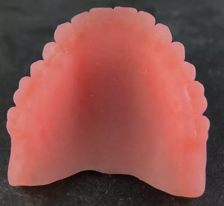 Abb. 7: Klarer Vorteil gegenüber dem analogen Verfahren: Das gedruckte Duplikat der vorhandenen Prothese (Denture Base OP, Formlabs) erfüllt gleich mehrere Kriterien und erleichtert den Arbeitsaufwand sowohl in der Praxis als auch im Labor.