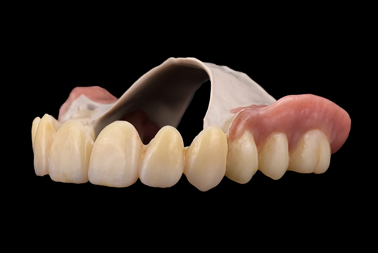 Abb. 21: Mit nur minimalen Oberflächenveredelungen war eine natürliche Ästhetik entstanden.