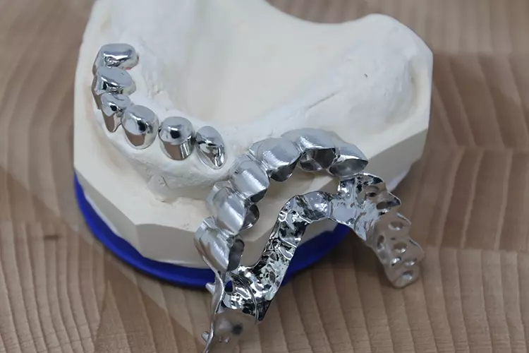 Abb. 7: Patient und Behandler sind mit der Arbeit zufrieden.