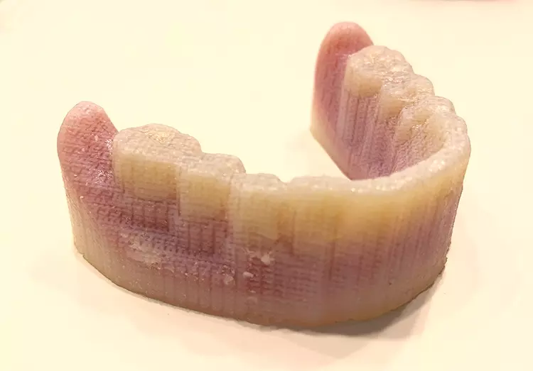 Abb. 7: TrueDent-Prothese (Stratasys) mit wasserlöslicher Supportstruktur.
