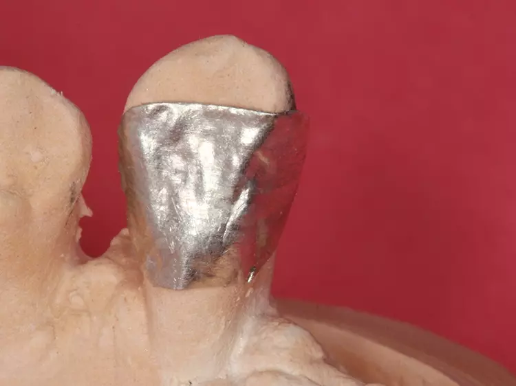 Abb. 7: Übertragung der Klebefläche mittels Zinnfolie.