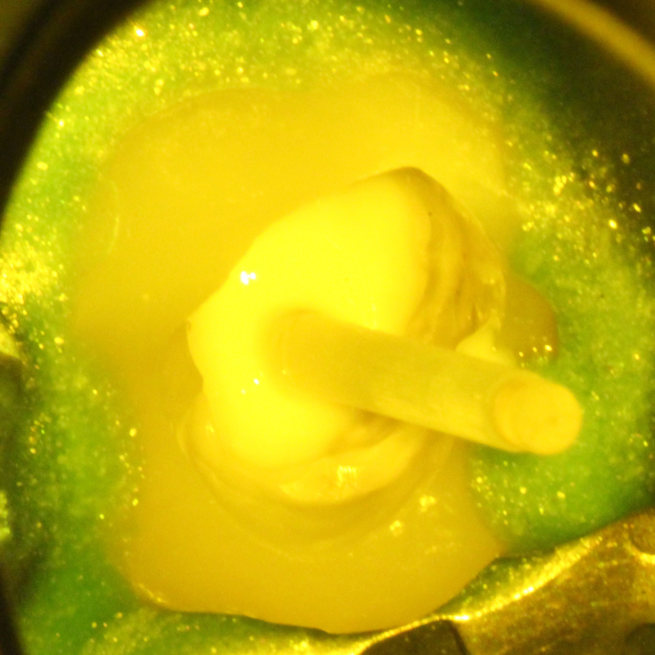 Abb. 57: Verklebung des Stiftes mit Visalys CemCore Opaque unter Einschwenkung des Gelbfilters des Mikroskops.