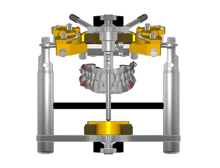 Abb. 8–10: Die CAD-Konstruktion erfolgte auf der Basis der Daten aus dem 3D-Intraoralscanner mit der Zirkonzahn Modellier-Software (Version v.6173_6843_x64).