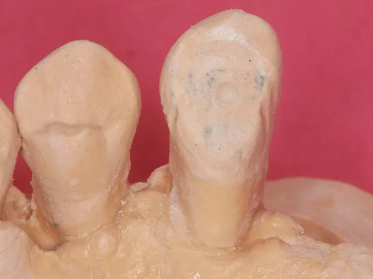 Abb. 8: Ausmessen der Klebefläche mittels Millimeterpapier.