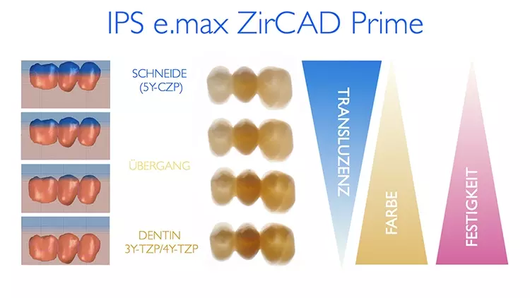 Abb. 9: IPS e.max ZirCAD Prime als Beispiel für ein Zirkonoxid der Gradiententechnologie
(Mehrgenerationen-Technologie). Der IPS e.max ZirCAD Prime-Rohling
weist eine zweidimensionale Schichtung aus unterschiedlichen Zirkonoxid-Generationen
auf.