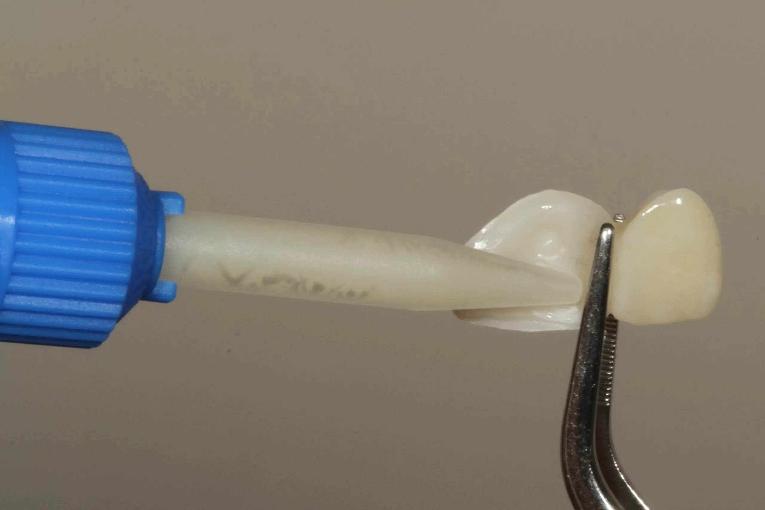 Abb. 50: Das Befestigungskomposit Visalys Cem-Core wurde direkt auf den Klebeflügel aufgebracht.