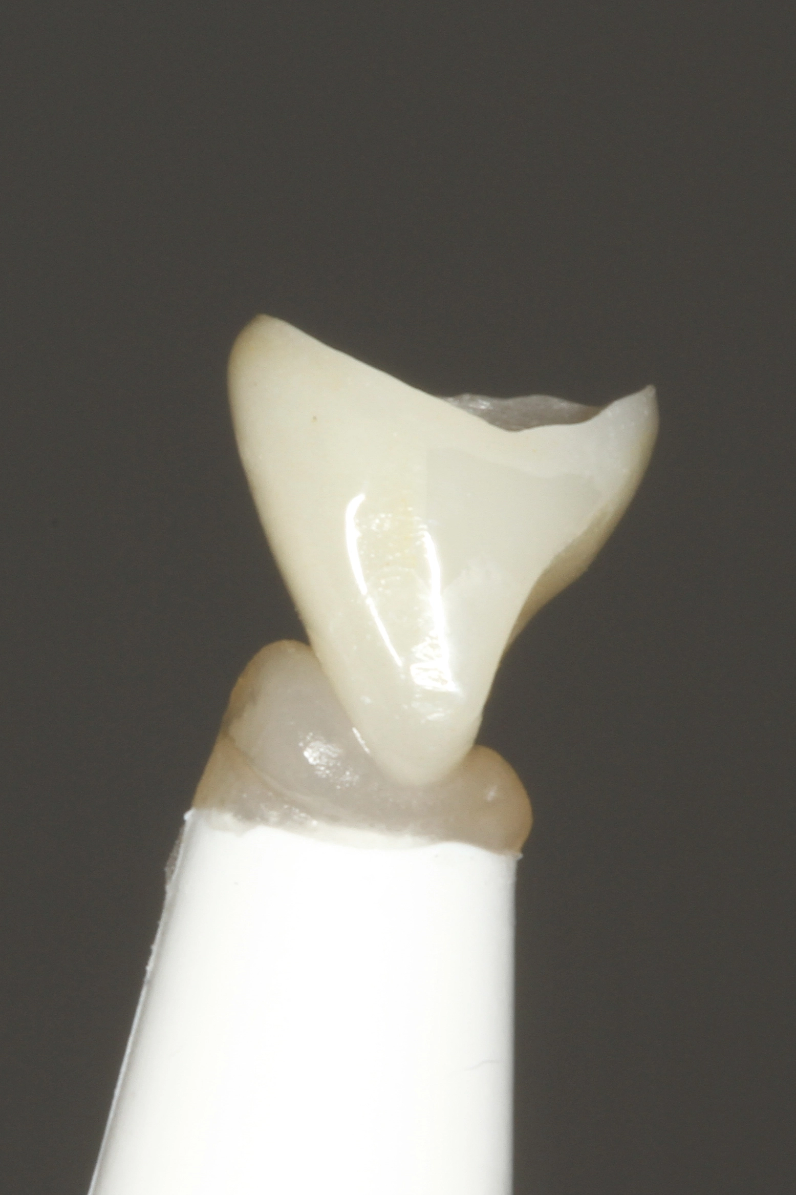 Abb. 15: Inzisale Befestigung der Krone an einem Pinselhalter mit
einem lichthärtenden gummielastischen Provisoriummaterial.