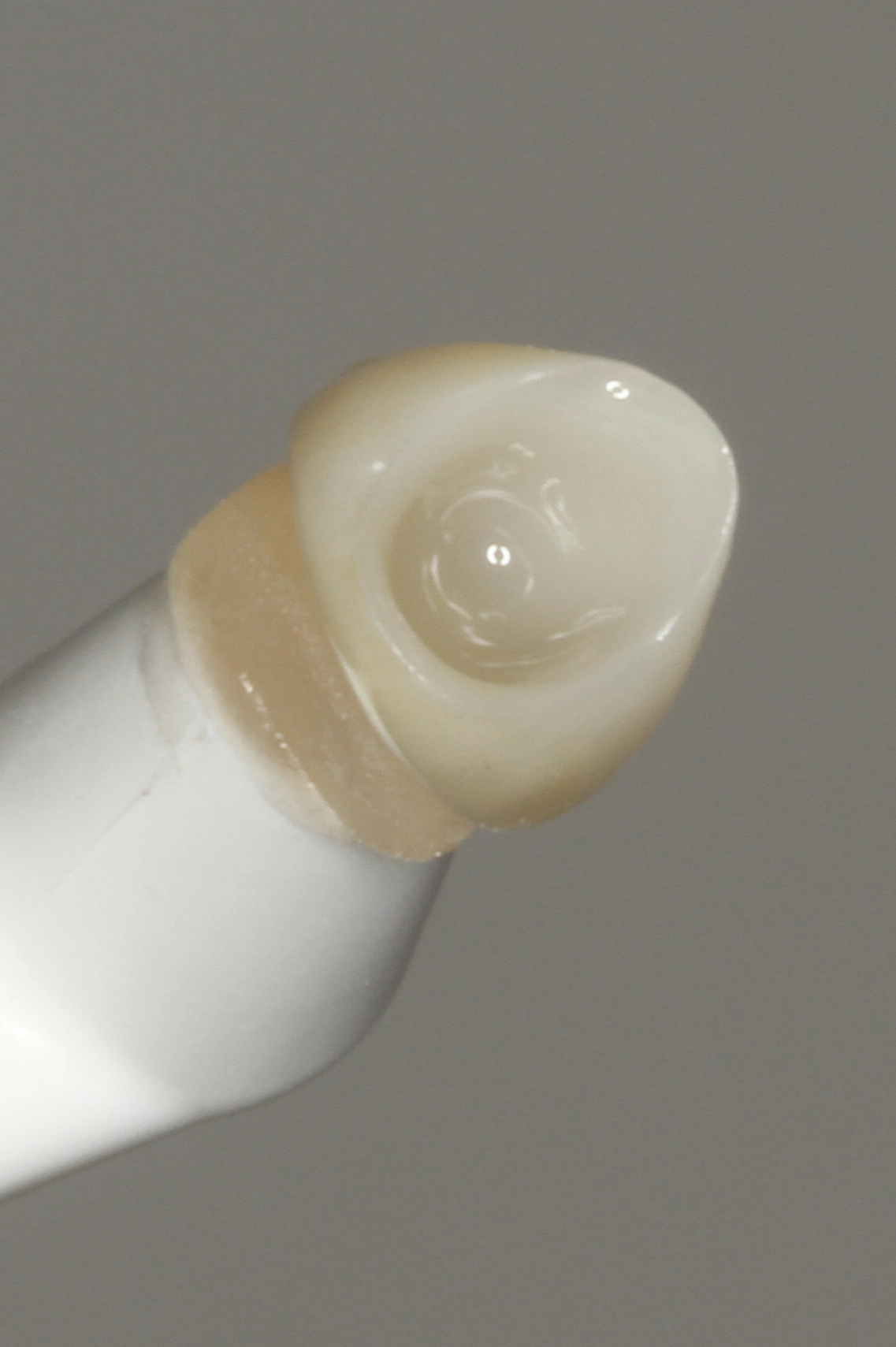 Abb. 18: Der MDP/Silan-haltige Visalys Restorative Primer wirkte im Anschluss 60 Sek. auf der Klebefläche ein.