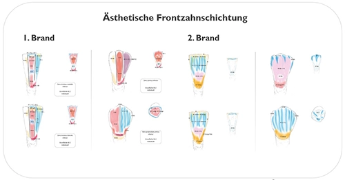 Abb. 8: Individuelles Schichtschema.