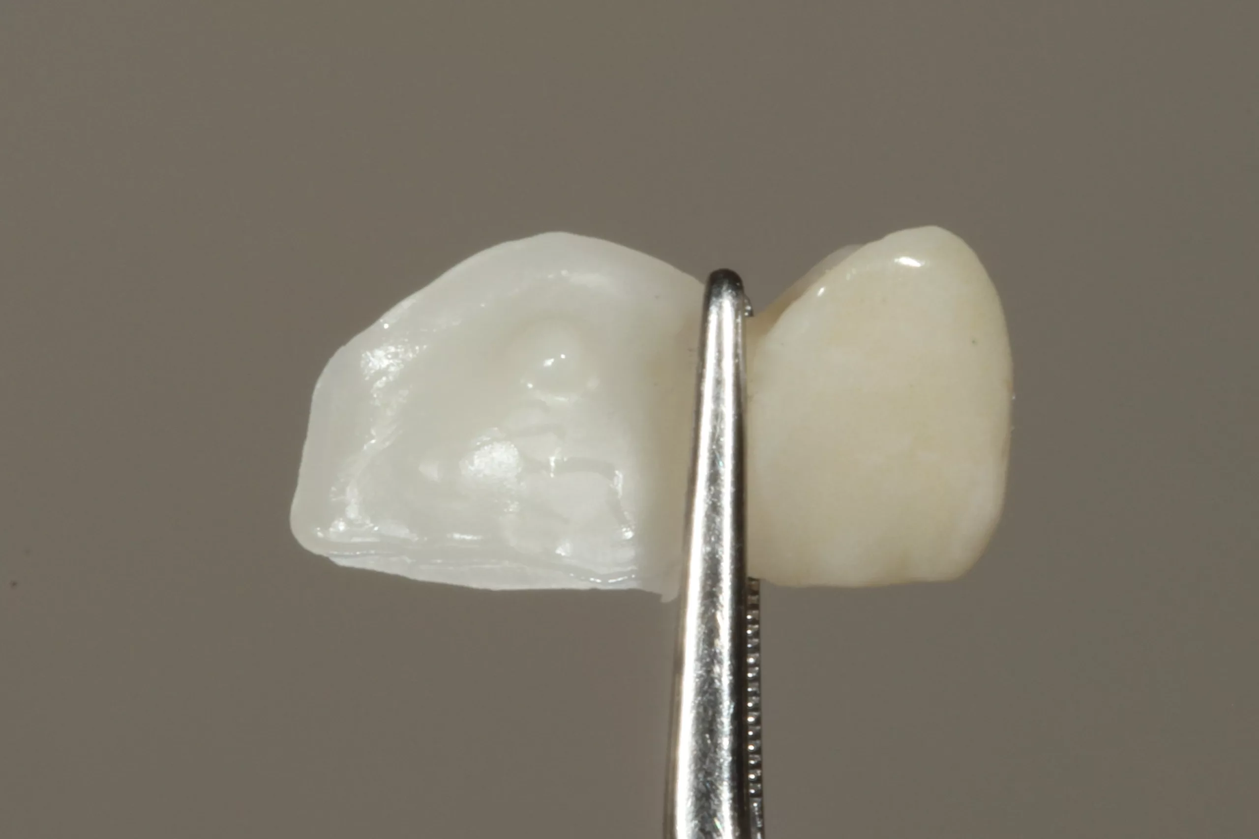 Abb. 43: Die mit dem Visalys Restorative Primer benetzte Klebefläche nach Evaporation des Lösungsmittels.