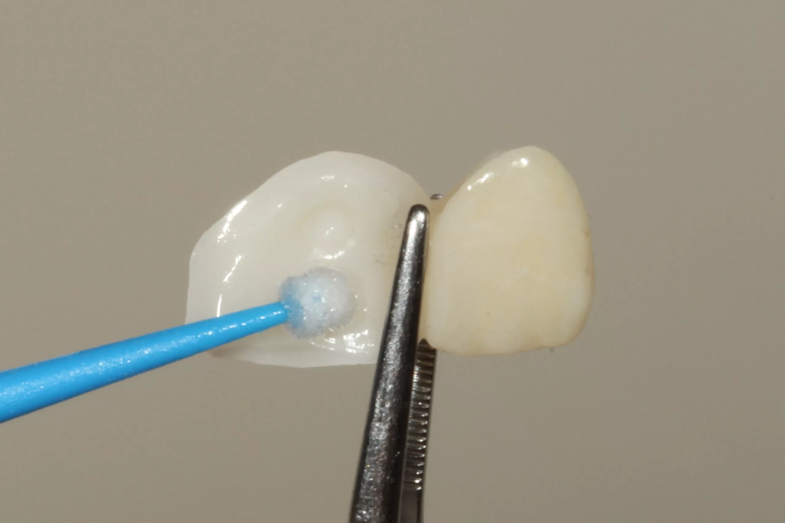 Abb. 42: Applikation des Visalys Restorative Primers.