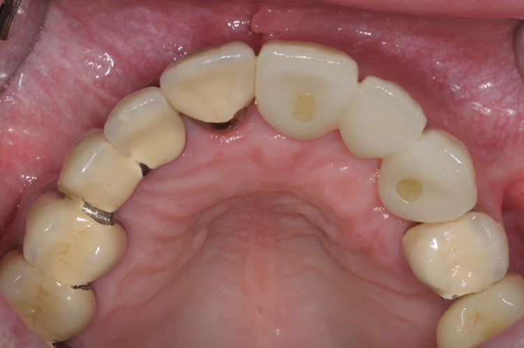 Abb. 19: Okklusale Ansicht des Behandlungsergebnisses.