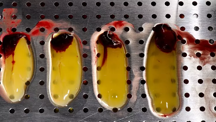 Abb. 11: Vier L-PRF Clots nach einer 12-minütigen Zentrifugation und Entnahme
aus den Glasröhrchen.