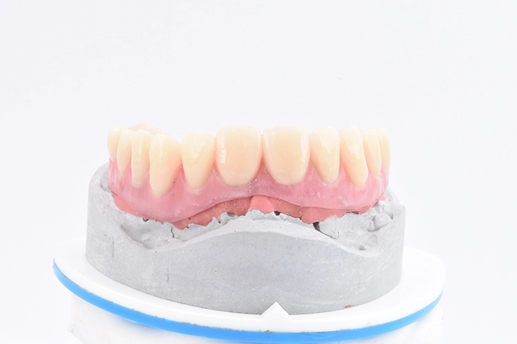 Abb. 14: Wax-up.