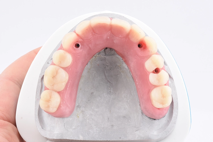 Abb. 15: Wax-up.
